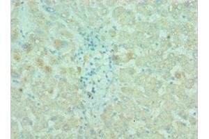 Immunohistochemistry of paraffin-embedded human liver tissue using ABIN7145198 at dilution of 1:100 (BIRC2 anticorps  (AA 1-300))