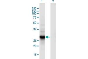 Western Blot analysis of RGS18 expression in transfected 293T cell line by RGS18 monoclonal antibody (M02), clone 1G12.