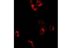 Immunofluorescent analysis of Decorin staining in MCF7 cells.