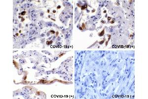 Immunohistochemical analysis of paraffin-embedded COVID-19 patient lung tissue using anti-SARS-CoV-2 (COVID-19) Spike S2 antibody (ABIN1030641, 0.