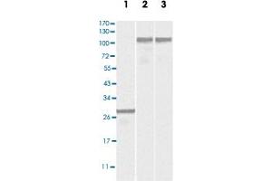 Western blot analysis using DNM2 monoclonal antibody, clone 5E4C2F3  against truncated DNM2 recombinant protein (Lane 1), SK-N-SH (Lane 2) and NIH/3T3 (Lane 3) cell lysates. (DNM2 anticorps)