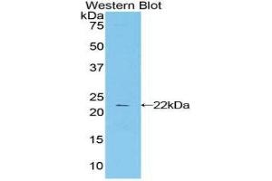 Western Blotting (WB) image for anti-Cytotoxic T-Lymphocyte-Associated Protein 4 (CTLA4) (AA 52-211) antibody (ABIN1858526) (CTLA4 anticorps  (AA 52-211))