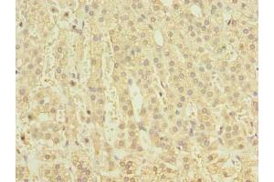 Immunohistochemistry of paraffin-embedded human adrenal gland tissue using  at dilution of 1:100 (CLEC4C anticorps  (AA 45-213))