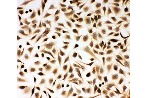 Anti-Smad2 antibody, ICC ICC: HELA Cell