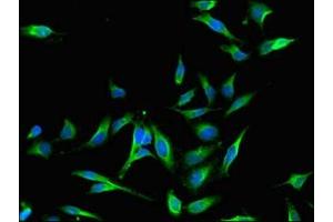 Immunofluorescent analysis of Hela cells using ABIN7159758 at dilution of 1:100 and Alexa Fluor 488-congugated AffiniPure Goat Anti-Rabbit IgG(H+L)