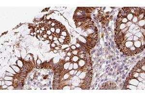 ABIN6272858 at 1/100 staining Mouse colon tissue by IHC-P. (IFT20 anticorps)