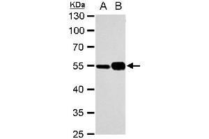 WB Image alpha Tubulin 1A antibody detects alpha Tubulin 1A protein by western blot analysis. (TUBA1A anticorps)