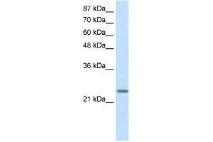 WB Suggested Anti-MXD3 Antibody Titration: 0. (MXD3 anticorps  (N-Term))