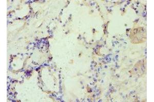 Immunohistochemistry of paraffin-embedded human prostate tissue using ABIN7144361 at dilution of 1:100 (alpha Adaptin anticorps  (AA 1-260))