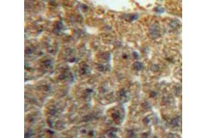 Used in DAB staining on fromalin fixed paraffin-embedded Liver tissue (IRF5 anticorps  (AA 3-250))