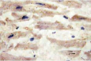 Immunohistochemistry (IHC) analyzes of Laminin alpha-4 antibody in paraffin-embedded human heart tissue. (LAMa4 anticorps)