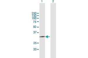 Western Blot analysis of ZCCHC9 expression in transfected 293T cell line by ZCCHC9 MaxPab polyclonal antibody. (ZCCHC9 anticorps  (AA 1-271))