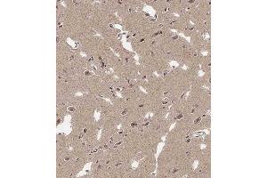 Immunohistochemical analysis of  on paraffin-embedded Human brain tissue.