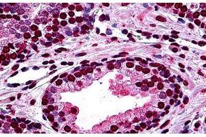 Human Prostate: Formalin-Fixed, Paraffin-Embedded (FFPE) (DLX2 anticorps  (AA 1-110))