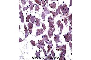 Immunohistochemistry (IHC) image for anti-Neurotrophic Tyrosine Kinase, Receptor, Type 1 (NTRK1) (pTyr791) antibody (ABIN3003427)