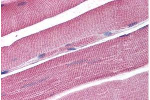 Human Skeletal Muscle (formalin-fixed, paraffin-embedded) stained with DCLRE1A antibody ABIN298128 at 2. (SNM1 anticorps  (AA 397-410))