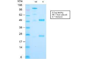 SDS-PAGE Analysis Purified Cytochrome C Recombinant Rabbit Monoclonal (CYCS/3128R). (Recombinant Cytochrome C anticorps)