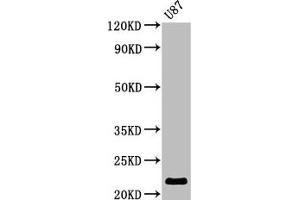 Western Blot Positive WB detected in: U87 whole cell lysate All lanes: AK1 antibody at 2. (Adenylate Kinase 1 anticorps  (AA 1-194))