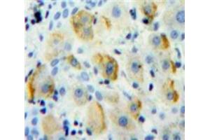 IHC-P analysis of Liver tissue, with DAB staining. (CD1d anticorps  (AA 56-271))