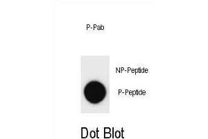 Dot blot analysis of Phospho-ERBB2- Antibody Phospho-specific Pab m on nitrocellulose membrane. (ErbB2/Her2 anticorps  (pTyr877))