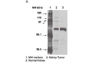 Western blot using CYP4F11 antibody one normal (2) and cancerous (3) kidney cell lysates. (CYP4F11 anticorps  (C-Term))