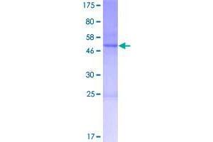 Image no. 1 for Cappuccino Homolog (CNO) (AA 1-217) protein (GST tag) (ABIN1349848)