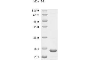 MAS-Related GPR, Member X1 (MRGPRX1) (AA 276-322) protein (His tag)