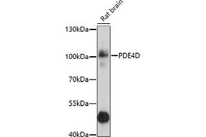 Western blot analysis of extracts of rat brain, using PDE4D antibody (ABIN3022336, ABIN3022337, ABIN3022338 and ABIN6218749) at 1:1000 dilution. (PDE4D anticorps  (AA 249-518))