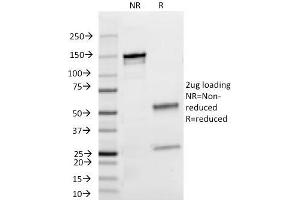 SDS-PAGE Analysis Purified Lambda Light Chain Mouse Monoclonal Antibody (HP6054). (IgL anticorps)