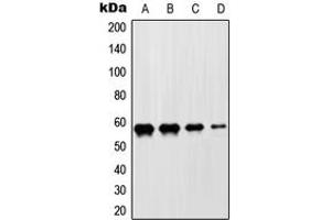 Western blot analysis of ZNF682 expression in HeLa (A), Jurkat (B), NIH3T3 (C), H9C2 (D) whole cell lysates. (ZNF682 anticorps  (N-Term))