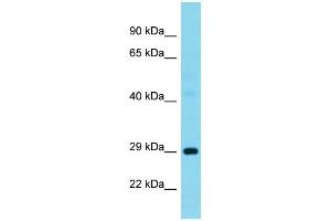 Host:  Rabbit  Target Name:  G3BP1  Sample Type:  Pancreas tumor lysates  Antibody Dilution:  1. (G3BP1 anticorps  (N-Term))