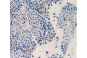 IHC-P analysis of Mouse Tissue, with DAB staining. (ACVR2A anticorps  (AA 326-485))