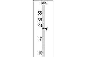 Western blot analysis in Hela cell line lysates (35ug/lane). (PRELID1 anticorps  (N-Term))
