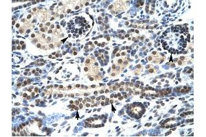 HTR3A antibody was used for immunohistochemistry at a concentration of 4-8 ug/ml to stain Epithelial cells of renal tubule (lndicated with Arrows] and renal corpuscle (Indicated with Arrow Heads) in Human Kidney. (Serotonin Receptor 3A anticorps  (N-Term))