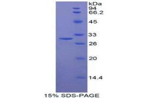 SDS-PAGE (SDS) image for MFNG (MFNG) (AA 80-316) protein (His tag) (ABIN2124127)