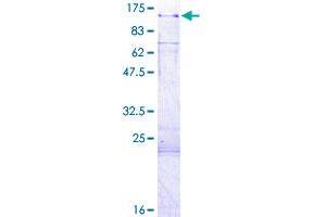 Image no. 1 for Kinase Suppressor of Ras 2 (KSR2) (AA 1-829) protein (GST tag) (ABIN1309083)
