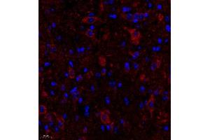 Immunofluorescence of paraffin embedded mouse spinal cord using FGF11 (ABIN7073941) at dilution of 1:2200 (400x lens)