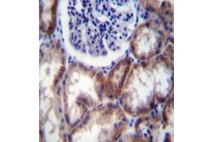 Immunohistochemistry analysis in formalin fixed and paraffin embedded human kidney tissue reacted with HYAL2 / Hyaluronidase-2 Antibody (Center) followed by peroxidase conjugation of the secondary antibody and DAB staining. (HYAL2 anticorps  (Middle Region))