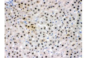 IHC analysis of NFIA using anti- NFIA antibody .