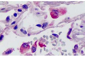 Human Lung: Formalin-Fixed, Paraffin-Embedded (FFPE) (Neurotrypsin anticorps  (N-Term))