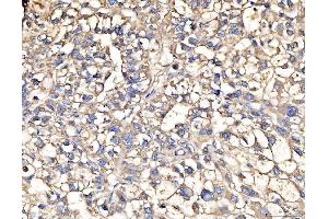 IHC analysis of AASS using anti-AASS antibody (ABIN7601519).