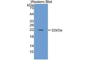 Western Blotting (WB) image for anti-CD40 (CD40) (AA 26-187) antibody (ABIN2118316) (CD40 anticorps  (AA 26-187))