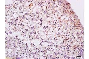 Formalin-fixed and paraffin embedded rat lung tissue labeled with Anti-ADCY9 Polyclonal Antibody, Unconjugated (ABIN751243) at 1:200 followed by conjugation to the secondary antibody and DAB staining (ADCY9 anticorps  (AA 251-350))