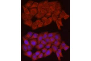 Immunofluorescence analysis of HeLa cells using Caspase-7 Rabbit pAb (ABIN3022071, ABIN3022072, ABIN3022073 and ABIN6218596) at dilution of 1:250 (40x lens).