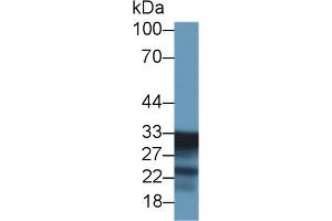 Detection of SDHB in Mouse Liver lysate using Polyclonal Antibody to Succinate Dehydrogenase Complex Subunit B (SDHB)