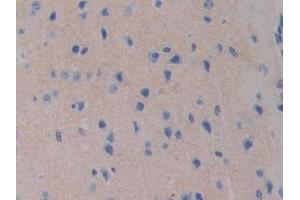 DAB staining on IHC-P; Samples: Mouse Cerebrum Tissue