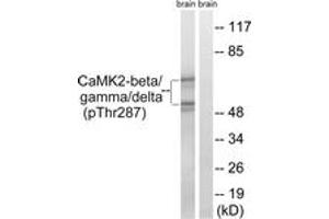 anti-CaMK2 beta/gamma/delta (AA 253-302), (pThr287) antibody