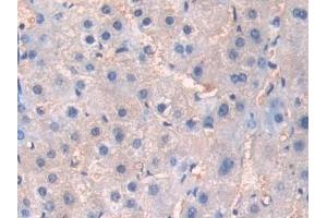 Detection of DSC1 in Human Liver Tissue using Polyclonal Antibody to Desmocollin 1 (DSC1)