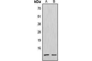 Western blot analysis of CXCL12 expression in Jurkat (A), NCIH292 (B) whole cell lysates. (CXCL12 anticorps  (C-Term))