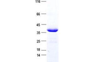 Validation with Western Blot (TGIF1 Protein (His tag))